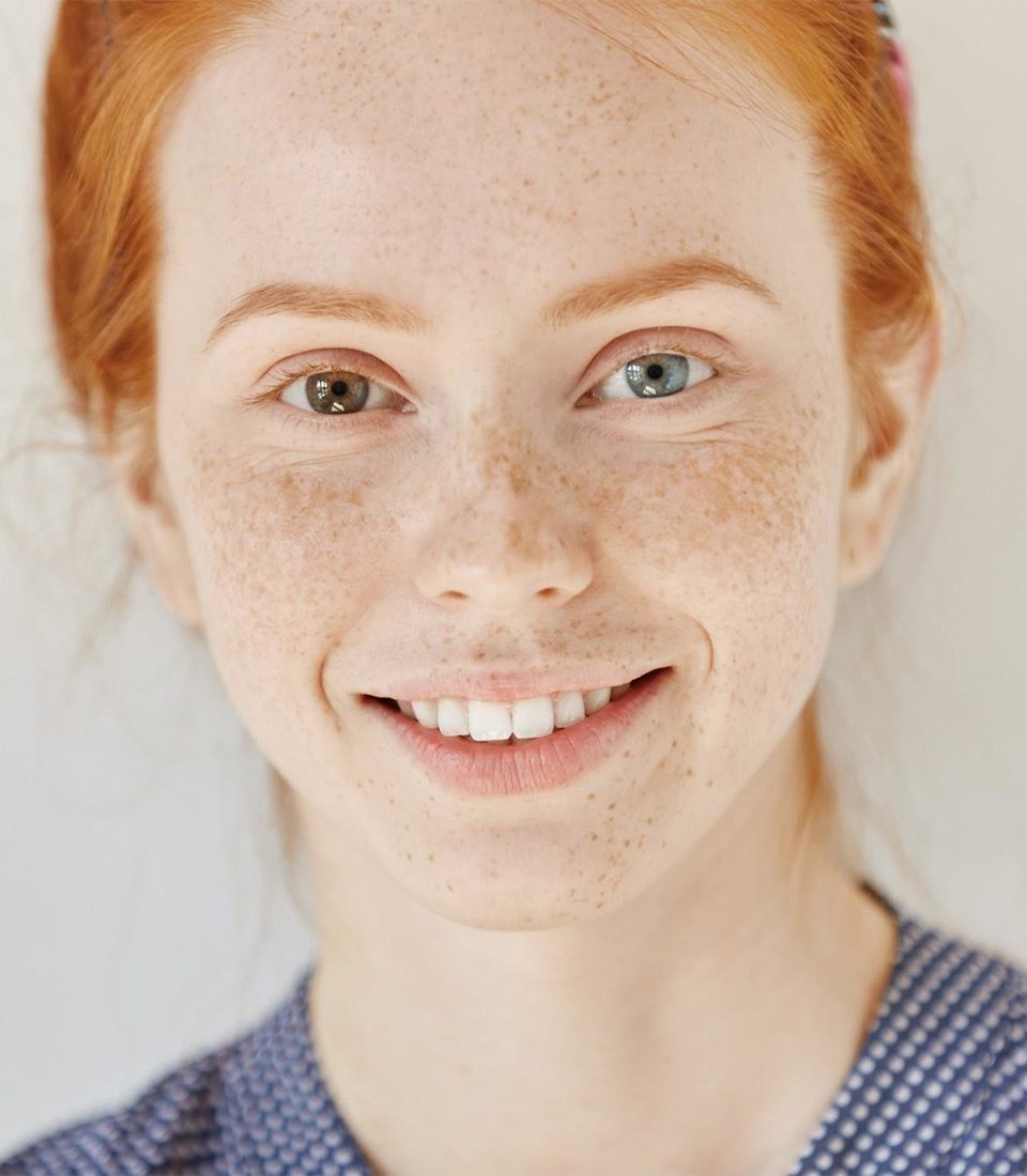 Pigmentation Marina Medical Center