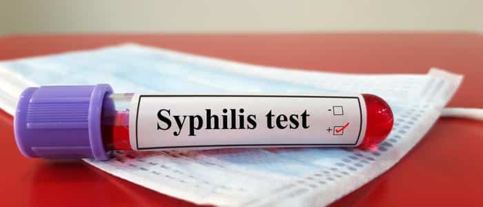 HIV-Syphilis-Hepatitis-STD-Testing