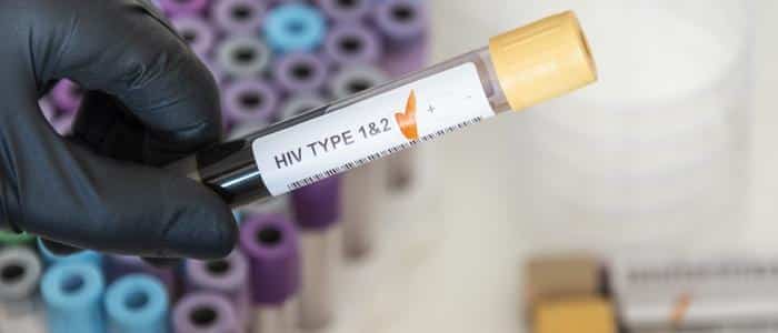 STD-Testing-HIV